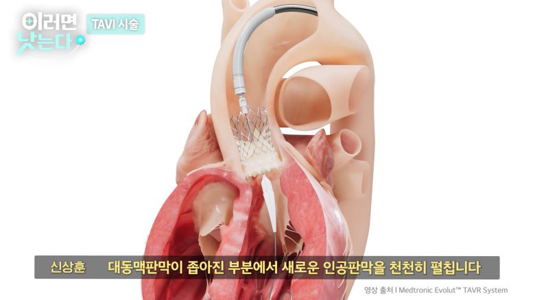 /조선일보 의학·건강 유튜브 '이러면 낫는다'