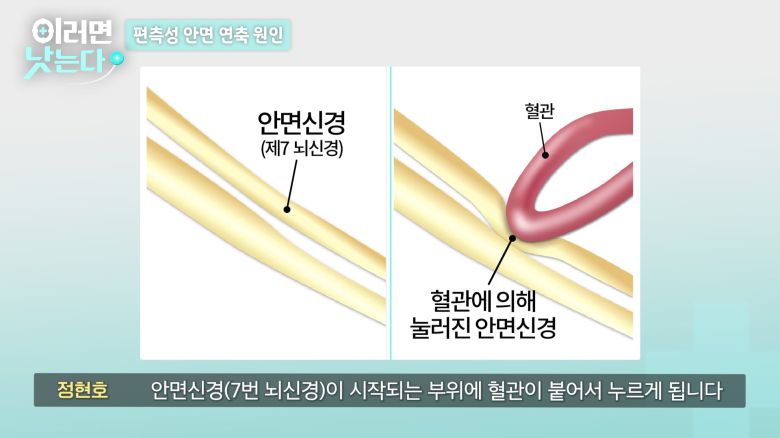 /조선일보 의학·건강 유튜브 '이러면 낫는다'