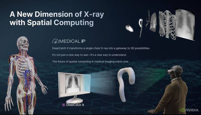 메디컬아이피는 AI 기반 3D 디지털 트윈 기술 및 의료 영상 분석 설루션 딥캐치 X를 서비스한다 / 출처=메디컬아이피