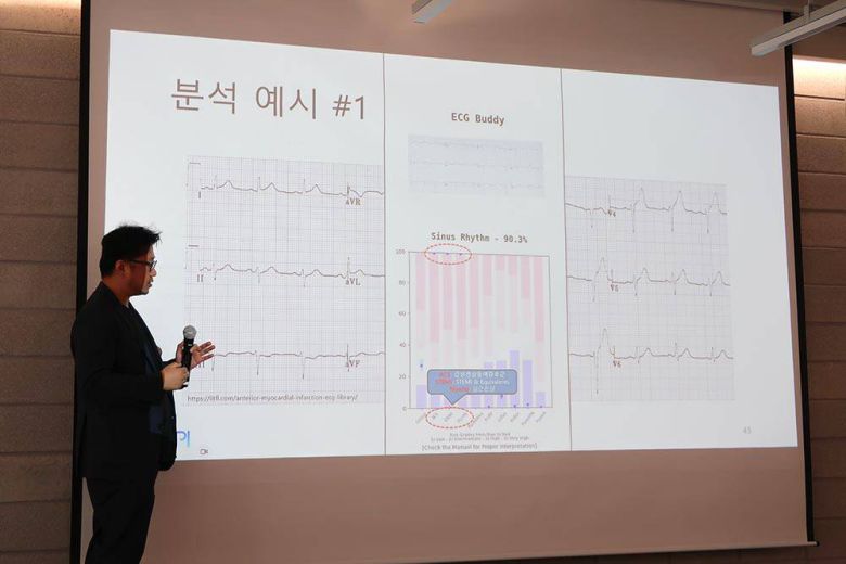 ECG버디는 심전도를 분석해 다양한 질환을 빠르게 예측한다 / 출처=IT동아