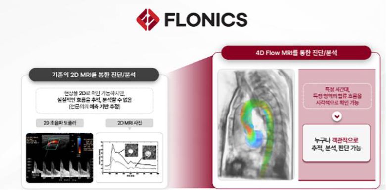 플로우닉스 4차원 혈류 분석 기술 / 출처=카카오벤처스