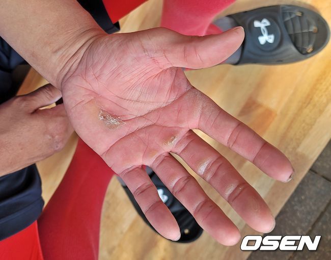 [OSEN=대구, 손찬익 기자] 굳은살 투성이인 삼성 라이온즈 포수 김태군의 손바닥 /what@osen.co.kr