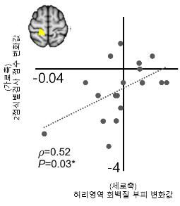 진짜 침 치료 시 허리영역 회백질 부피 변화값[한국한의학연구원 제공. 재판매 및 DB 금지]