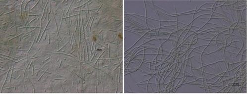 슈드아나베나(Pseudanabaena)와 플랑크토쓰릭스(Planktothrix)[국립환경과학원 제공. 재판매 및 DB 금지]