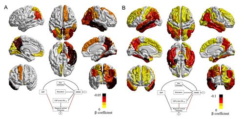 새로운 유전인자가 대뇌피질 위축을 일으키는 모습[KAIST 제공. 재판매 및 DB 금지]