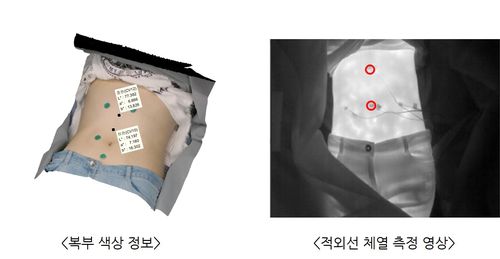 복진기 측정 사진[한국한의학연구원 제공. 재판매 및 DB 금지]