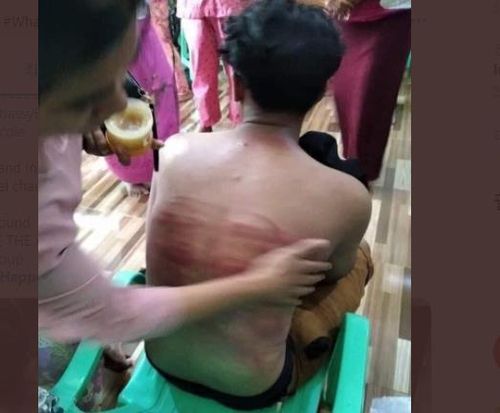 "체포만 하지 않고, 때리고 고문한다"[트위터 @mRPreNDmYzEkupF·재판매 및 DB 금지]