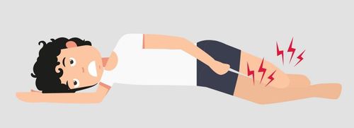 하지불안증후군(서울=연합뉴스) 하지불안증후군. 2021.03.26. [서울대병원 제공. 재판매 및 DB 금지]