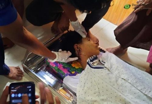 초 민 랏의 목 뒤 총상을 보여주는 유족들 [다웨이와치·재판매 및 DB 금지]