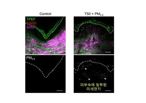 정상 피부와 미세먼지가 침투한 피부 비교[한국표준과학연구원 제공. 재판매 및 DB 금지]