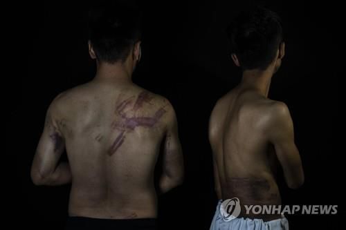 여성 시위 취재하다 탈레반에 폭행당한 아프간 기자들 [AP통신=연합뉴스 자료사진]