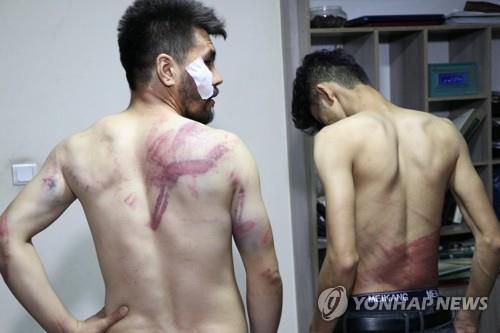 지난달 탈레반에 폭행당한 상처 보여주는 아프간 기자들  [로이터 연합뉴스 자료사진. 재판매 및 DB 금지]