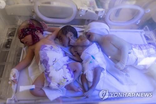 아프간 카불의 어린이 병원에서 아기 3명이 한 인큐베이터 안에서 치료받는 모습. [로이터 연합뉴스 자료사진. 재판매 및 DB 금지]