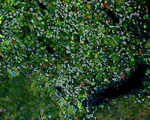 생쥐의 간경화 이미지[스페인 CNIO 제공. 재판매 및 DB 금지]