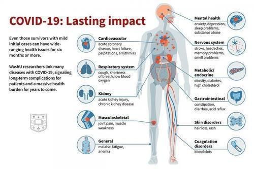 코로나19 회복 6개월 이내에 나타날 수 있는 후유증  [미국 세인트루이스 워싱턴 의대 Sara Moser 제공. 재판매 및 DB 금지]