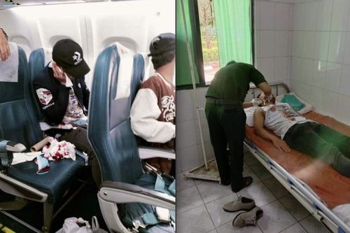 민항기 내에서 총알에 오른뺨과 귀를 다친 27세 승객[SNS 캡처. 재판매 및 DB 금지]