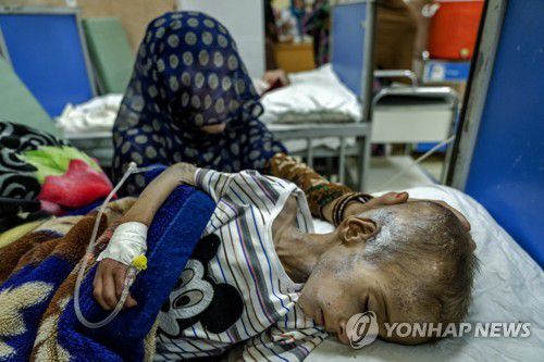 2022년 5월 카불 병원에 입원해 있는, 영양실조에 걸린 소년[AP 연합뉴스 자료사진. 재판매 및 DB 금지]