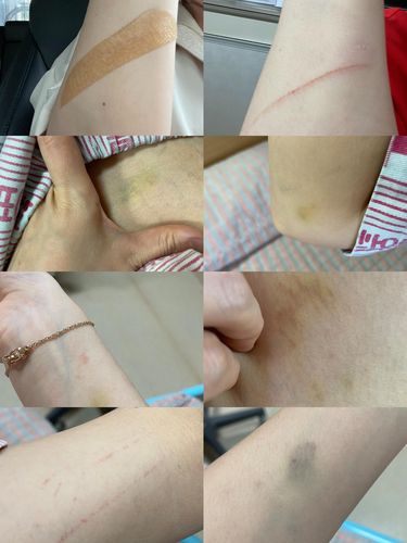 담임교사의 상처sunhyung@yna.co.kr