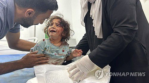 이스라엘 공습에 다친 팔레스타인 아기 [로이터 연합뉴스. 재판매 및 DB 금지]