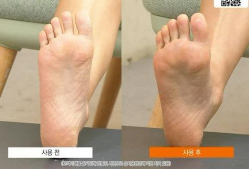각질제거제 판매 방송 장면[홈쇼핑 방송 화면 캡처. 재판매 및 DB 금지]