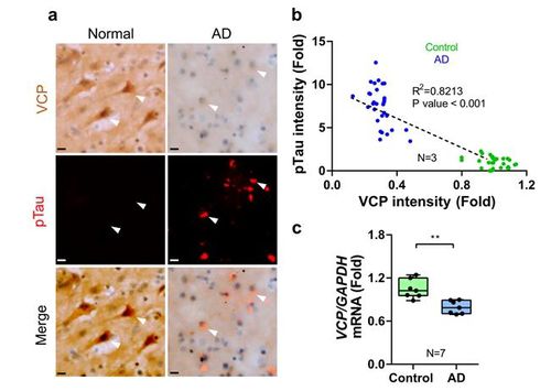 알츠하이머병 환자 뇌에서 발로신 함유 단백질(VCP)이 줄어든 모습[한국생명공학연구원 제공. 재판매 및 DB 금지]