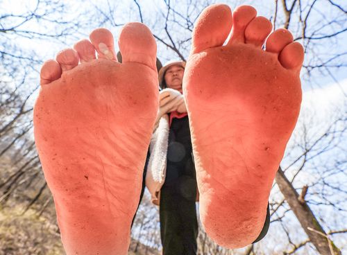 노랗게 물든 맨발을 들어 보이는 시민 [사진/임헌정 기자]