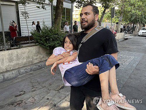 이란 테헤란에서 부상당한 아이[EPA=연합뉴스. 재판매 및 DB 금지]