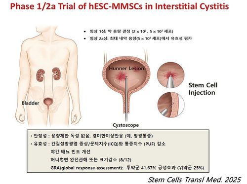 난치병 간질성방광염 세포치료 모식도[미래셀바이오 제공. 재판매 및 DB 금지]
