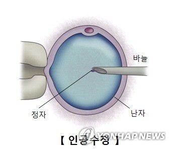 체외 수정[서울아산병원 제공]