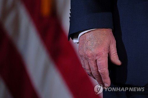 트럼프 미국 대통령의 손[로이터 연합뉴스 자료사진. 재판매 및 DB 금지]