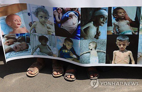 예멘 시위대가 들고 나온 기아 상태 가자 어린이들 사진 [EPA 연합뉴스 자료사진. 재판매 및 DB 금지]