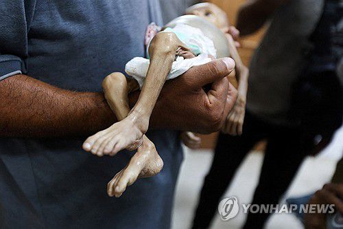 가자지구서 영양실조로 숨진 아이 자이나브 아부 할리브[로이터 연합뉴스 자료사진. 재판매 및 DB 금지]