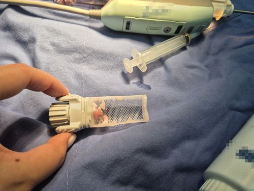 종양 제거 수술 시연 장면[부산경찰청 제공, 재판매 및 DB금지]