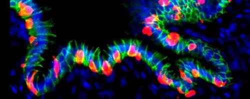 인슐린 분비하게 유전자 조작된 인간 위 오가노이드(hGO-NPM)연구팀은 인간배아줄기세포(hESC)로 위 오가노이드(hGO)를 만들고, 이 오가노이드에 췌장 베타세포 전사인자 핵심 유전자 3개(NPM : NEUROG3·PDX1·MAFA)를 삽입했다. 삽입된 유전자 3개는 도시사이클린(doxycycline)이라는 약물로 스위치를 켜고 끌 수 있도록 설계돼 약물을 투여하면 세포 내에서 이 인자들이 발현되며 위 세포가 인슐린 분비 세포로 전환된다. [Hyunkee Kim/Harvard University 제공. 재판매 및 DB 금지]