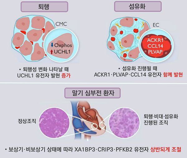 희귀·난치성 심근병증, 발병 단계·조직 손상 따라 달라지는 유전자 규명