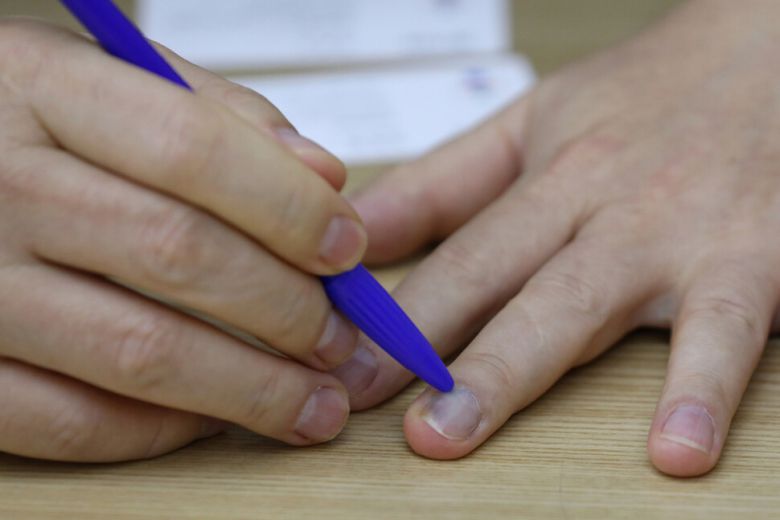 초등학교만 졸업한 뒤 경기도 성남의 여러 공장에서 일했던 이재명 경기도지사는 소년공 시절에 왼쪽 팔이 굽고, 손가락에 고무가 박히는 산재를 당했다. 지난달 29일 오후 경기도청 상황실에서 한 <한겨레>와의 인터뷰에서 이 지사가 고무 가루가 박혀서 손톱 색깔이 변해 있는 자신의 손가락을 보여주고 있다. 수원/장철규 선임기자 chang21@hani.co.kr