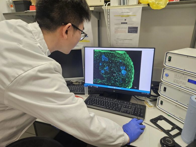 연구진이 컴퓨터로 치아 세포를 살펴보고 있다. 킹스칼리지런던 제공