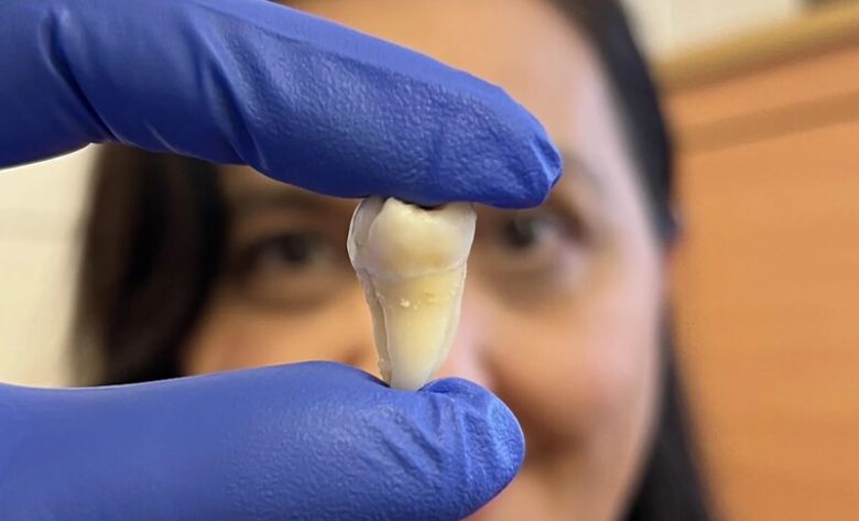 영국 킹스칼리지런던 연구진이 실험실에서 세포 배양을 통해 만든 치아. 킹스칼리지런던 제공