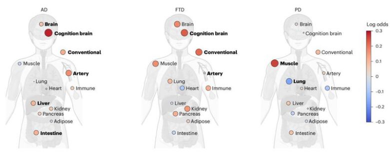 장기 노화의 정도(생체 연령과 실제 연령의 격차)와 알츠하이머병(AD), 전두측두엽 치매(FTD), 파킨슨병(PD)과의 연관성을 보여주는 그림. 빨간색은 장기의 노화 정도가 질병과 양의 연관성이 있음을, 파란색은 음의 연관성이 있음을 나타낸다. 크기가 큰 원은 연관성 또는 중요도가 크다는 것을 뜻한다. Nature Medicine
