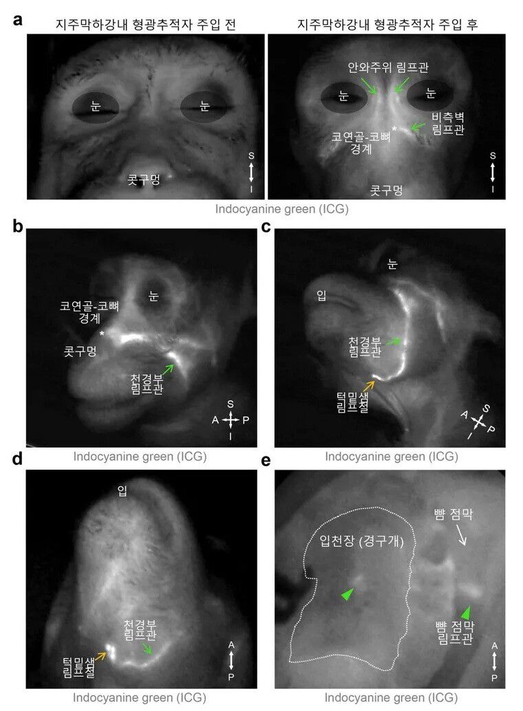 영장류에서 관찰된 뇌척수액 배출 림프관 분포. 뇌막에 주입된 뇌척수액 형광 물질이 눈 주위, 코 옆, 턱과 목 사이 림프관을 거쳐 턱밑샘 림프절에 쌓이는 모습이 확인됐다. 입천장과 뺨 안쪽 점막 림프관에서도 형광이 관찰돼 생쥐 실험 결과와 일치한다. 기초과학연구원 제공