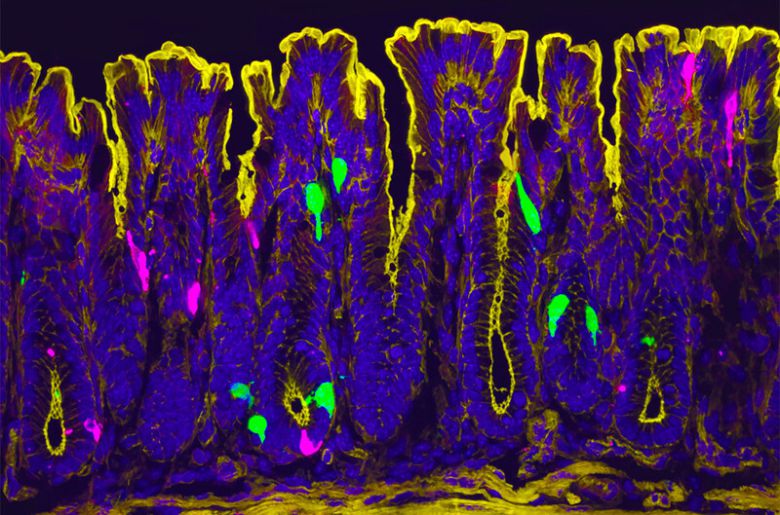 대장의 내벽을 확대한 사진. 여성 호르몬인 에스트로겐은 대장의 엘세포(녹색)와 세로토닌 생성 세포인 크롬친화세포(자홍색)의 신호 전달 기능을 활성화해 통증 신호를 증가시키는 것으로 나타났다. 이는 여성이 과민성 대장 증후군에 더 민감한 이유를 설명해준다. 샌프란시스코 캘리포니아대 제공