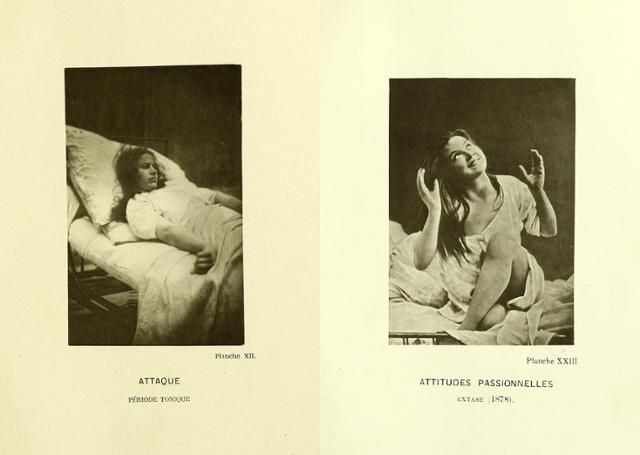 프랑스 신경학자 장 마르탱 샤르코가 치료했던 히스테리아 여성 환자들의 모습이 실린 책 '살페트리에르 병원의 초상 사진' 일부. 웰컴콜렉션 제공