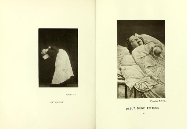 프랑스 신경학자 장 마르탱 샤르코가 치료했던 히스테리아 여성 환자들의 모습이 실린 책 '살페트리에르 병원의 초상 사진' 일부. 웰컴콜렉션 제공