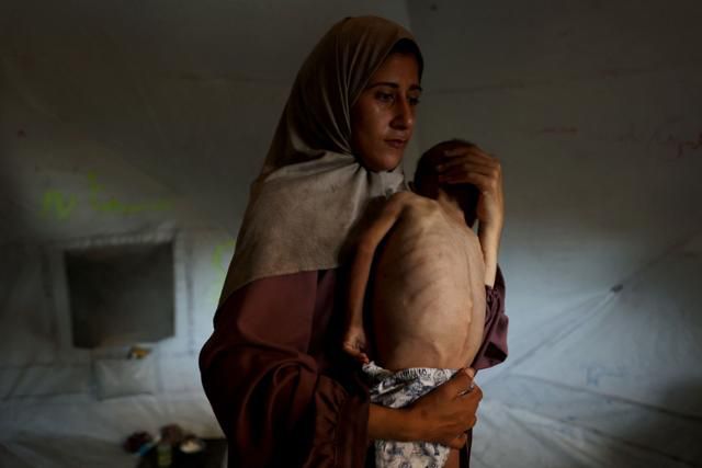 생후 18개월 된 아기 모하메드 알무타와크가 지난달 24일 팔레스타인 가자지구 알샤티 난민 캠프에서 어머니의 품에 안겨 있다. 미국 뉴욕타임스(NYT)는 지난달 25일 두 모자의 사진을 신문 1면에 게재하며 아기가 건강하게 태어났지만, 최근 심각한 영양실조로 진단됐다는 어머니의 설명을 전했으나, 나흘 뒤 병원 등을 통해 아기에게 기저 질환이 있다는 새로운 정보를 알게 됐다고 밝혔다. 베냐민 네타냐후 이스라엘 총리는 이달 10일 NYT 보도를 가짜뉴스라고 주장하며 법적 대응을 고려하고 있다고 밝혔다. 가자=AFP 연합뉴스