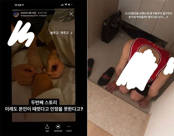 배구선수 정지석의 전 여자친구가 정지석에게 폭행을 당했었다며 인스타그램에 올린 사진. [트위터 캡처]