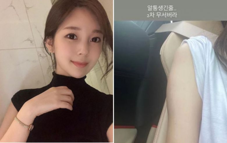 야옹이 작가(왼쪽)이 공유한 모더나 백신 접종후 팔이 부은 모습 [SNS 캡처]