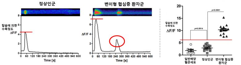 정상인군 및 변이형 협심증 환자군의 칼슘에 의한 수축정도 비교(좌) 및 정량화 결과(우) 칼슘 농도를 정량화하자 정상인군과 환자군을 확실히 구분할 수 있었다.