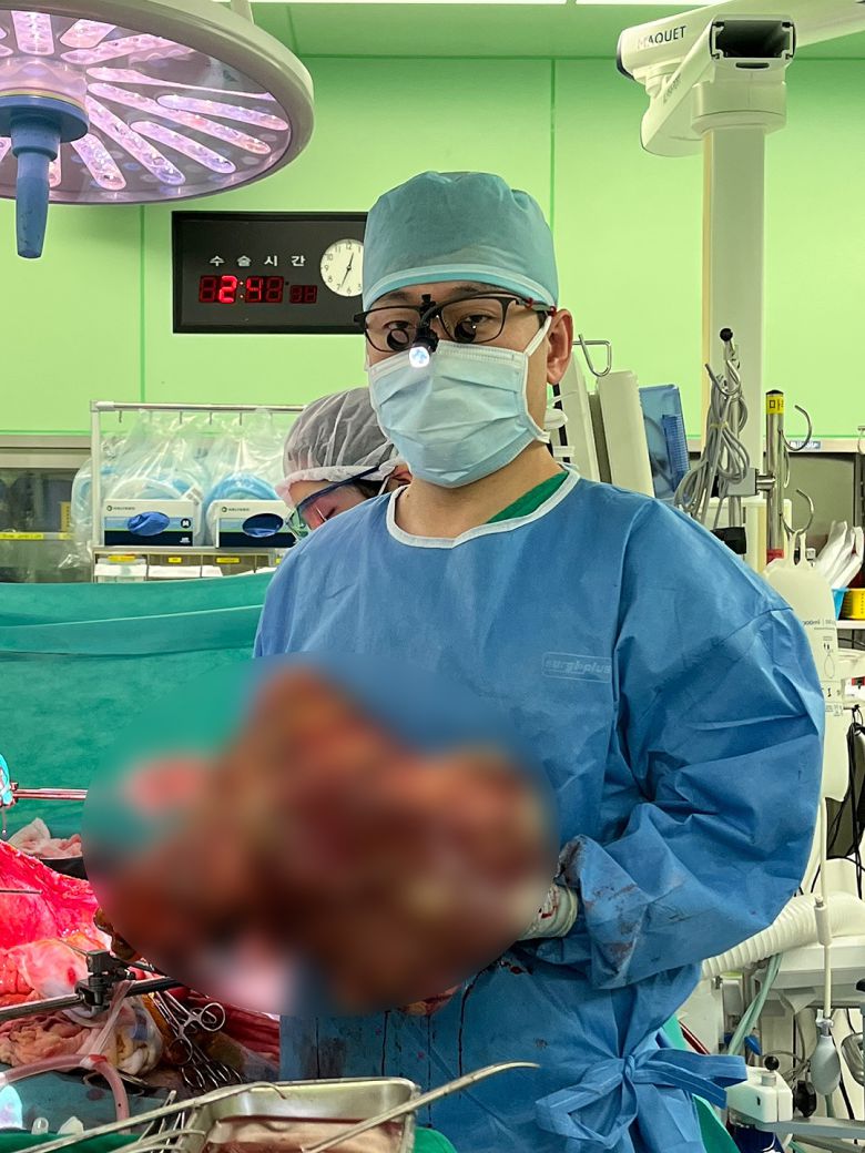 이재근 교수가 수술 당시 환자에게서 제거한 간을 들고 있다.