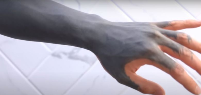 열일곱 살 때 친구엄마로부터 전체 커버 문신을 한 사연자. [유튜브 ‘문신 지우는 영수쌤’ 캡처]