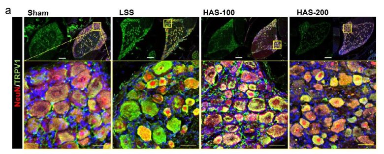 [사진설명] 신경세포의 실험군별 통증 수용체(TRPV1) 발현 모습.하르파고사이드 투여군에서 초록색으로 염색된 TRPV1이 감소한 것을 확인할 수 있다.